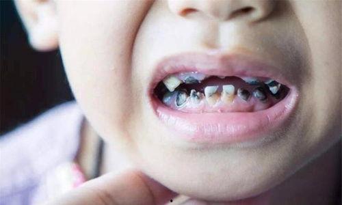 没牙怎么吃瓜  第1张